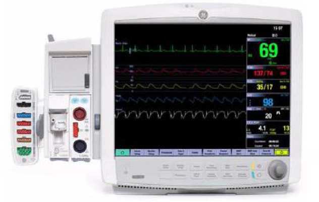 Внешний вид. Мониторы пациента , http://oei-analitika.ru рисунок № 1