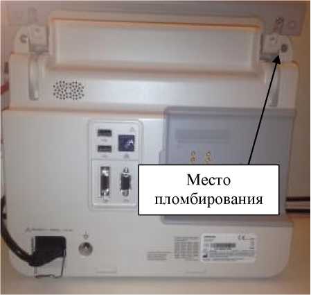 Внешний вид. Мониторы пациента , http://oei-analitika.ru рисунок № 6