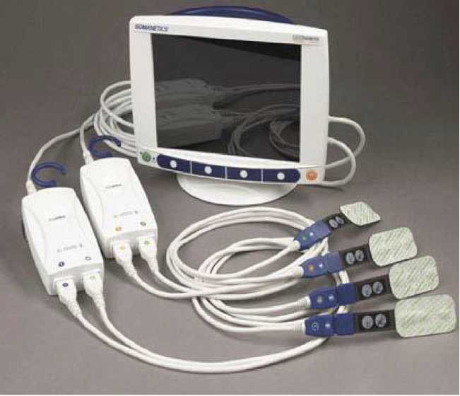 Внешний вид. Оксиметры церебральные/ соматические, http://oei-analitika.ru рисунок № 1